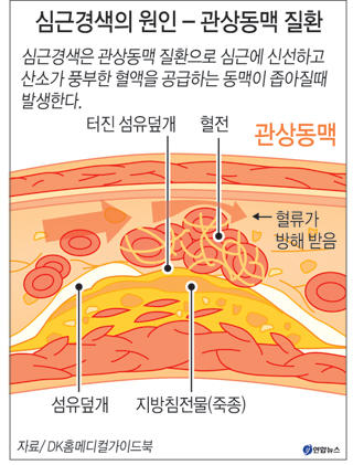 산업재해 스토리텔링 – 13. 심근경색 3
