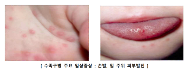 사진 = 질병관리청 제공