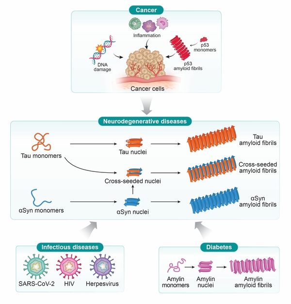 난치성 질환-질환 연계 모델. 단백질의 오접힘 현상, 아밀로이드 피브릴형성과 같은 단백질 응집, 그리고 크로스 시딩(Cross-seeding)은 알츠하이머병과 파킨슨병과 같은 신경퇴행성 질환을 연계함. 또 감염병, 암, 당뇨병은 단백질 오접힘, 응집, 염증, 신호전달 이상의 분자적 영향을 받아 신경퇴행성 질환과 연계가 됨. KBSI 제공